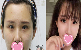 通過(guò)郭建玲眼綜合真人案例看北京京民是否正規(guī)靠譜？